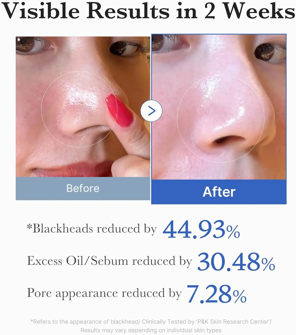 Zero Pore Pads 2.0 (70 pads) Medicube