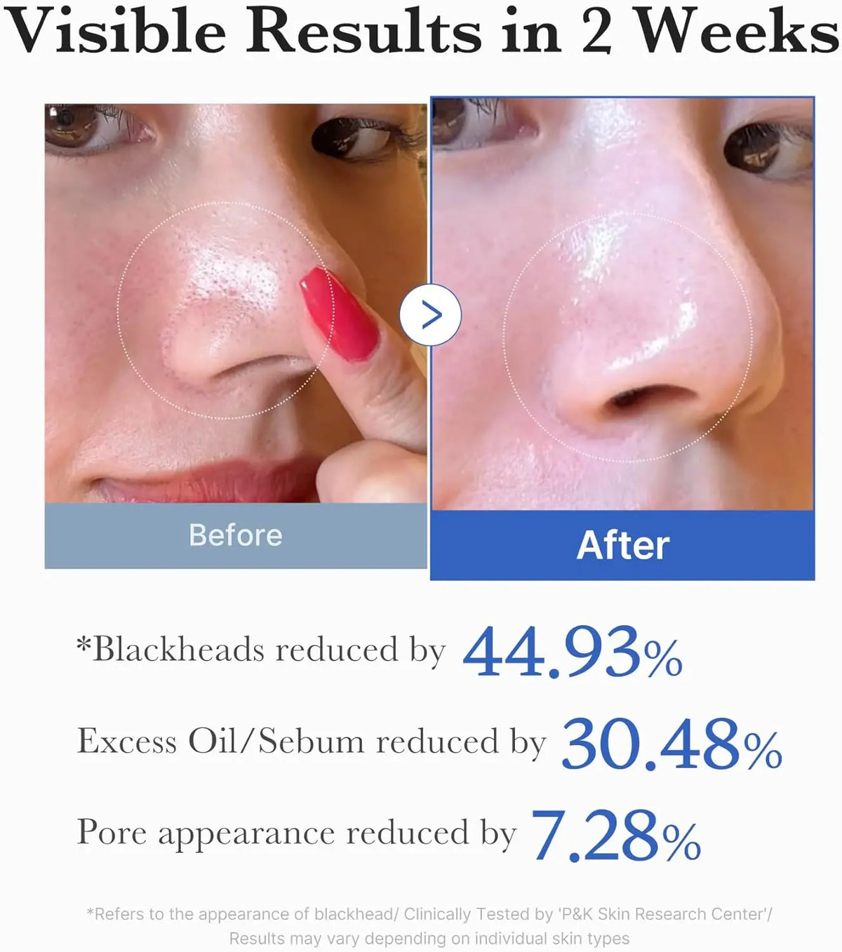 Zero Pore Pads 2.0 (70 pads) Medicube