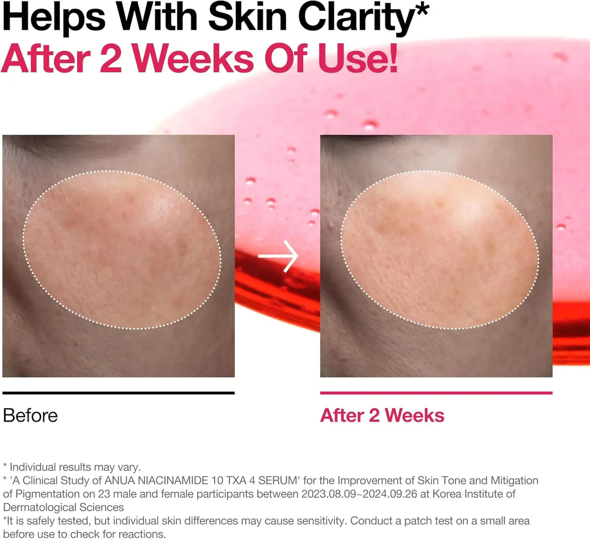 Niacinamide 10% + TXA 4% Dark Spot Correcting  30ml Anua