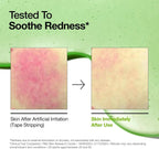 10+ Azelaic Acid 10 Hyaluron Redness Soothing Serum 30ml Anua