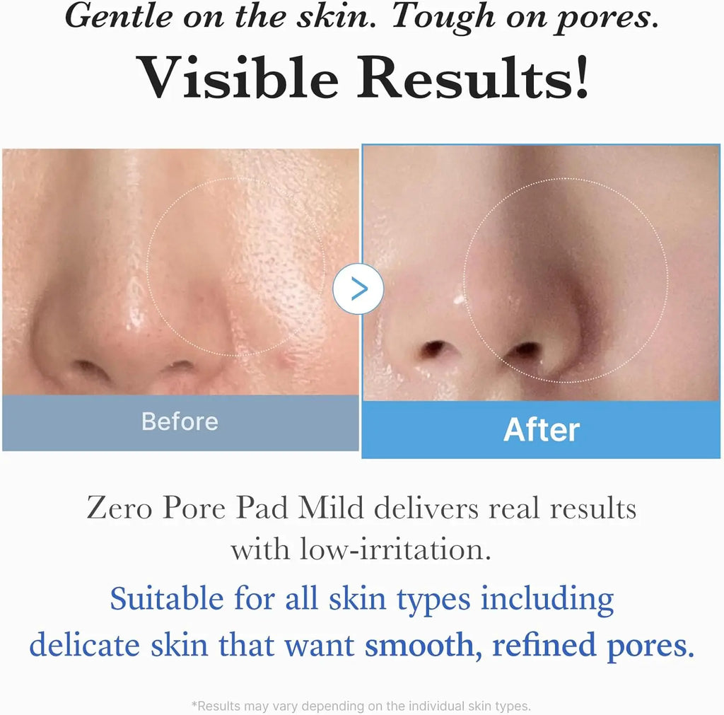 Zero Pore Pads Mild (70 pads) Medicube