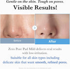 Zero Pore Pads Mild (70 pads) Medicube