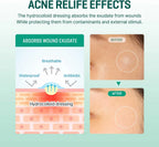 30 days Miracle Clear Spot Patches (18 patchs) SOME BY MI
